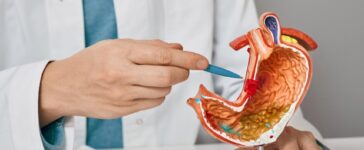 Gastric Sleeve Revision