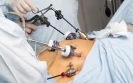 Gastric Bypass Surgery