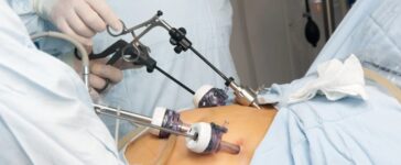 Gastric Bypass Surgery